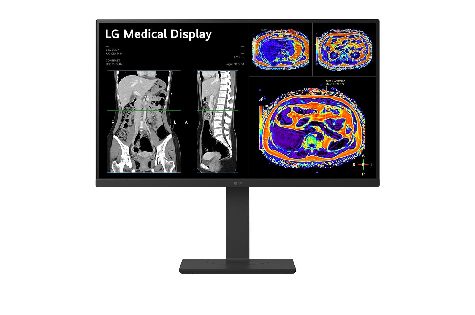 LG 27HS713C 27″ 8MP IPS clinical review monitor, front product view